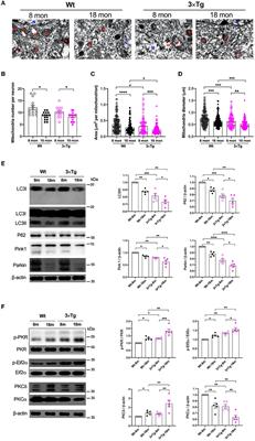 The role of PKC/PKR in aging, Alzheimer's disease, and perioperative neurocognitive disorders